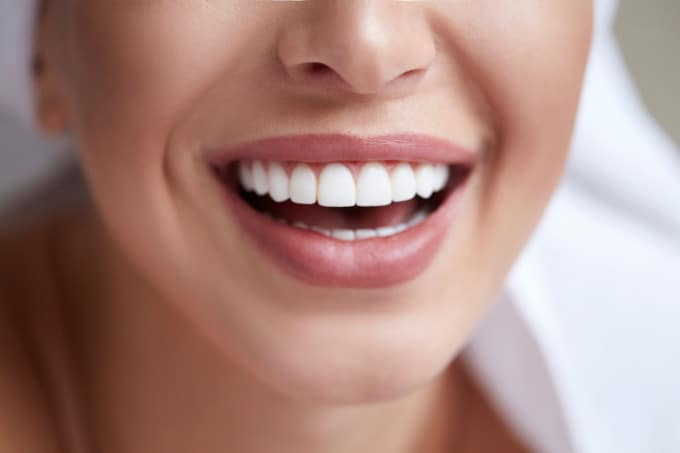 woman smiling with nice white teeth
