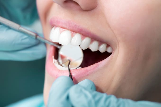 What To Expect From a Deep Teeth Cleaning